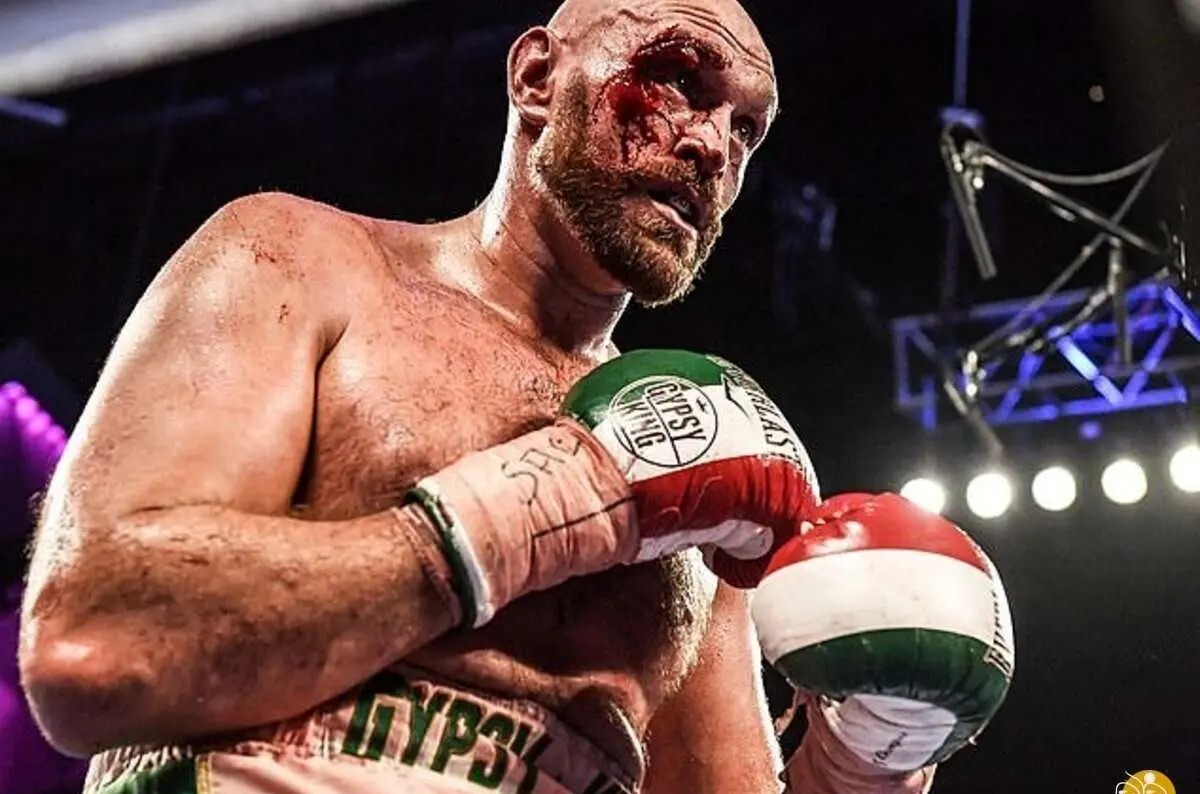 قهرمان افسانهای بوکس جهان؛ فیوری: هرگز به رینگ برنمیگردم قهرمان افسانهای بوکس جهان؛ فیوری: هرگز به رینگ برنمیگردم